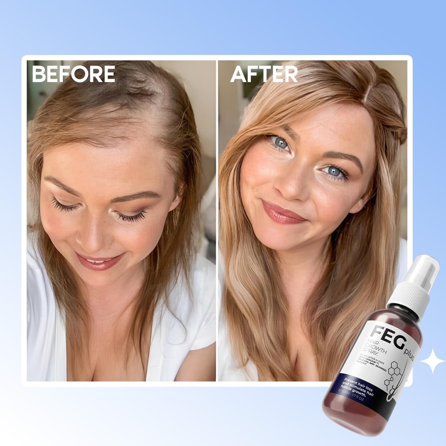 FEG Plus Hair Growth Spray